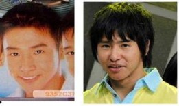 娱乐圈吃瓜爆料男星整容,男星整容风波，真相背后竟是这样...